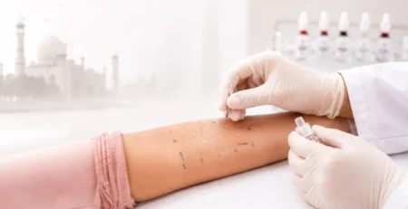 Illustration of a clinician performing a forearm skin prick allergy test