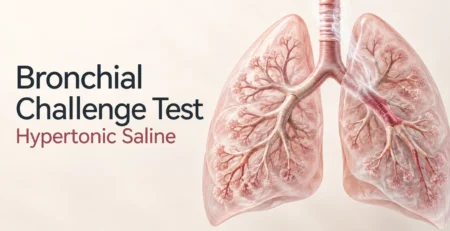 Bronchial challenge test with hypertonic saline — illustration of lung airways.