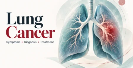 Illustration of lungs with a highlighted lesion beside the title Lung Cancer