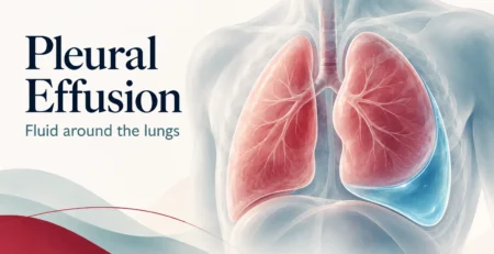 Illustration of fluid around left lung